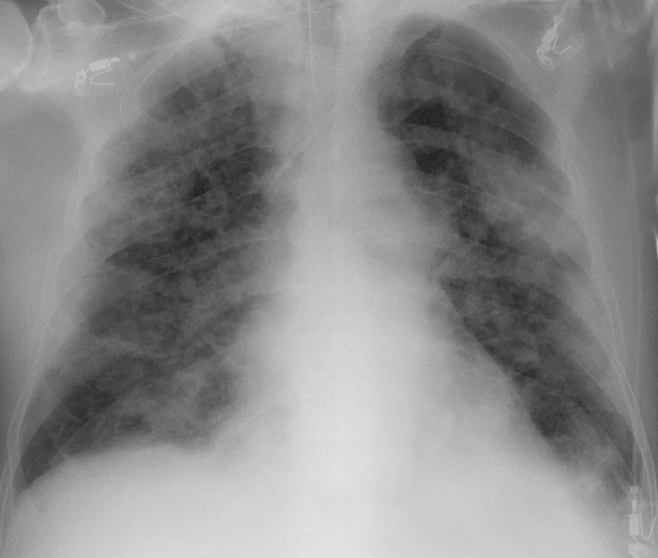 Chest radiograph for self-assessment
