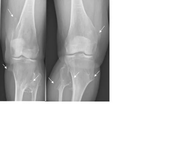 Bone & joint disease radiograph for self-assessment