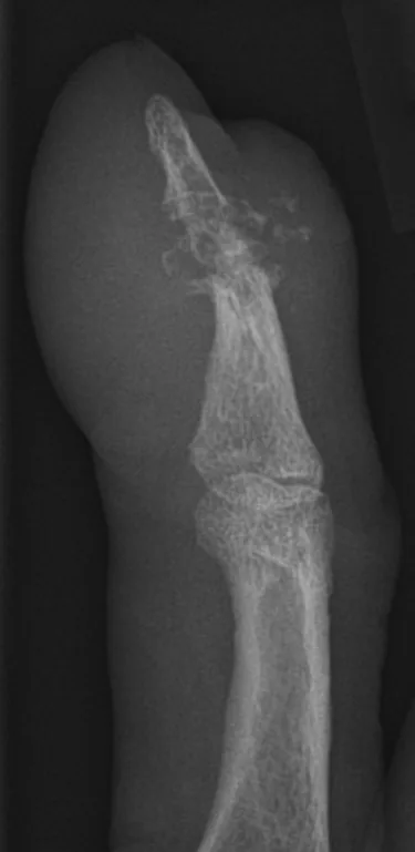 Bone & joint disease radiograph for self-assessment