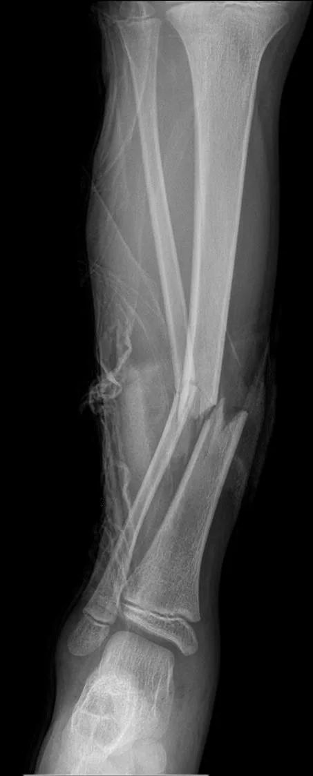 Lower limb radiograph for self-assessment