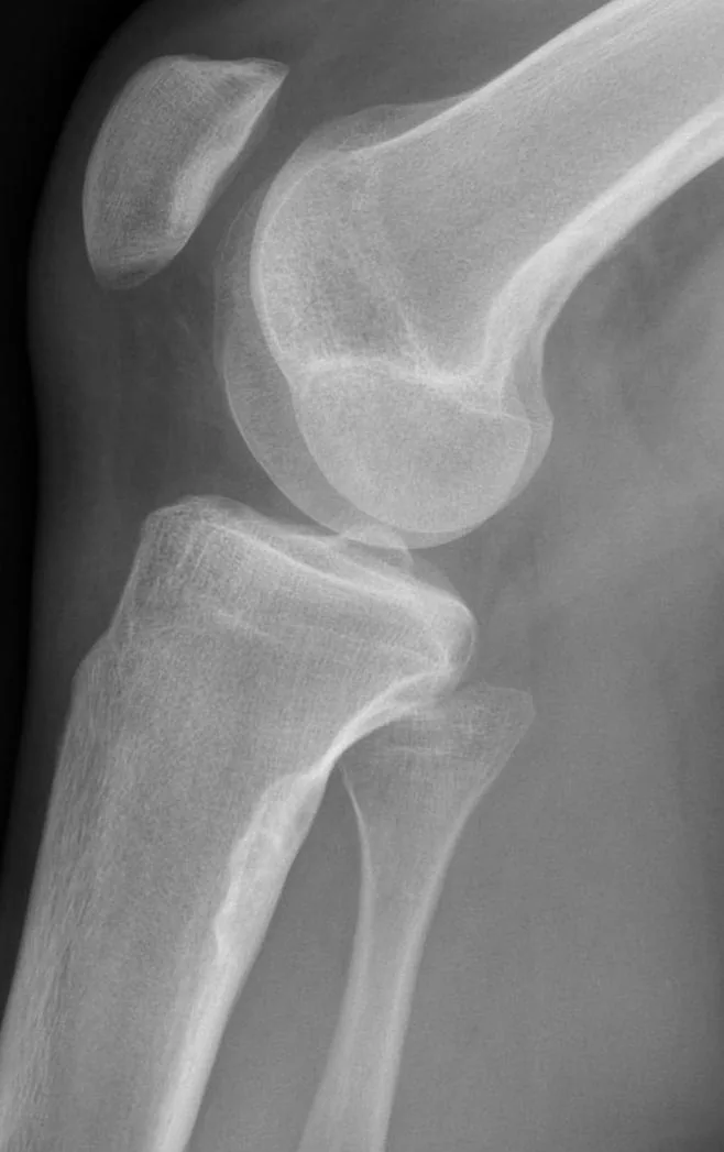 Bone & joint disease radiograph for self-assessment