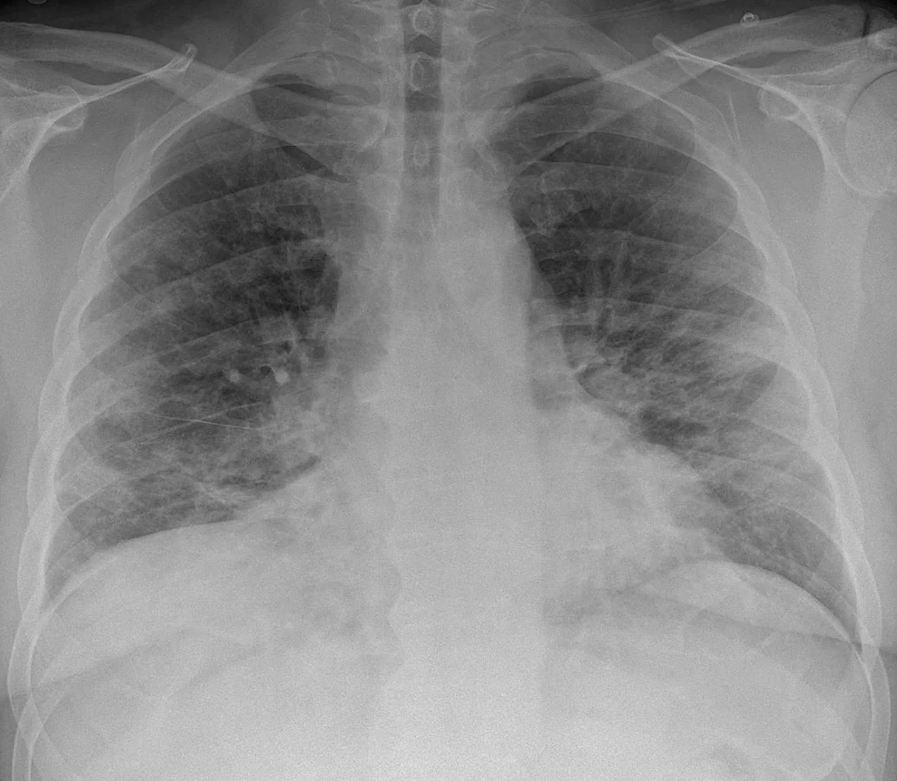 Chest radiograph for self-assessment