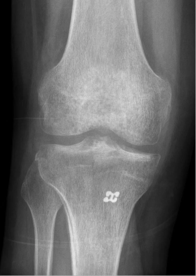 Bone & joint disease radiograph for self-assessment