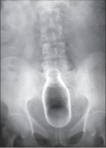Abdomen radiograph for self-assessment