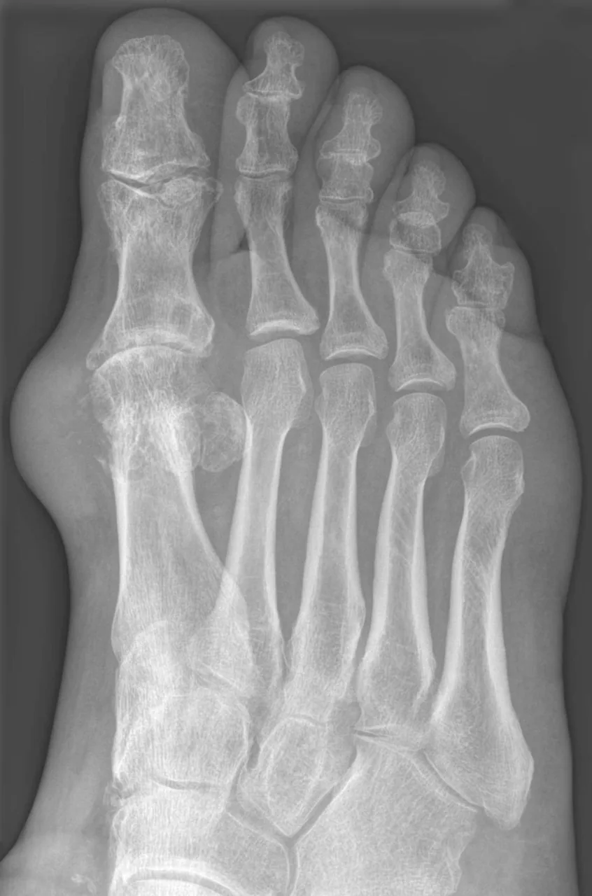 Bone & joint disease radiograph for self-assessment