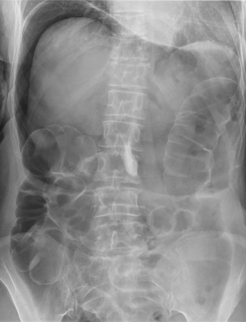 Abdomen radiograph for self-assessment