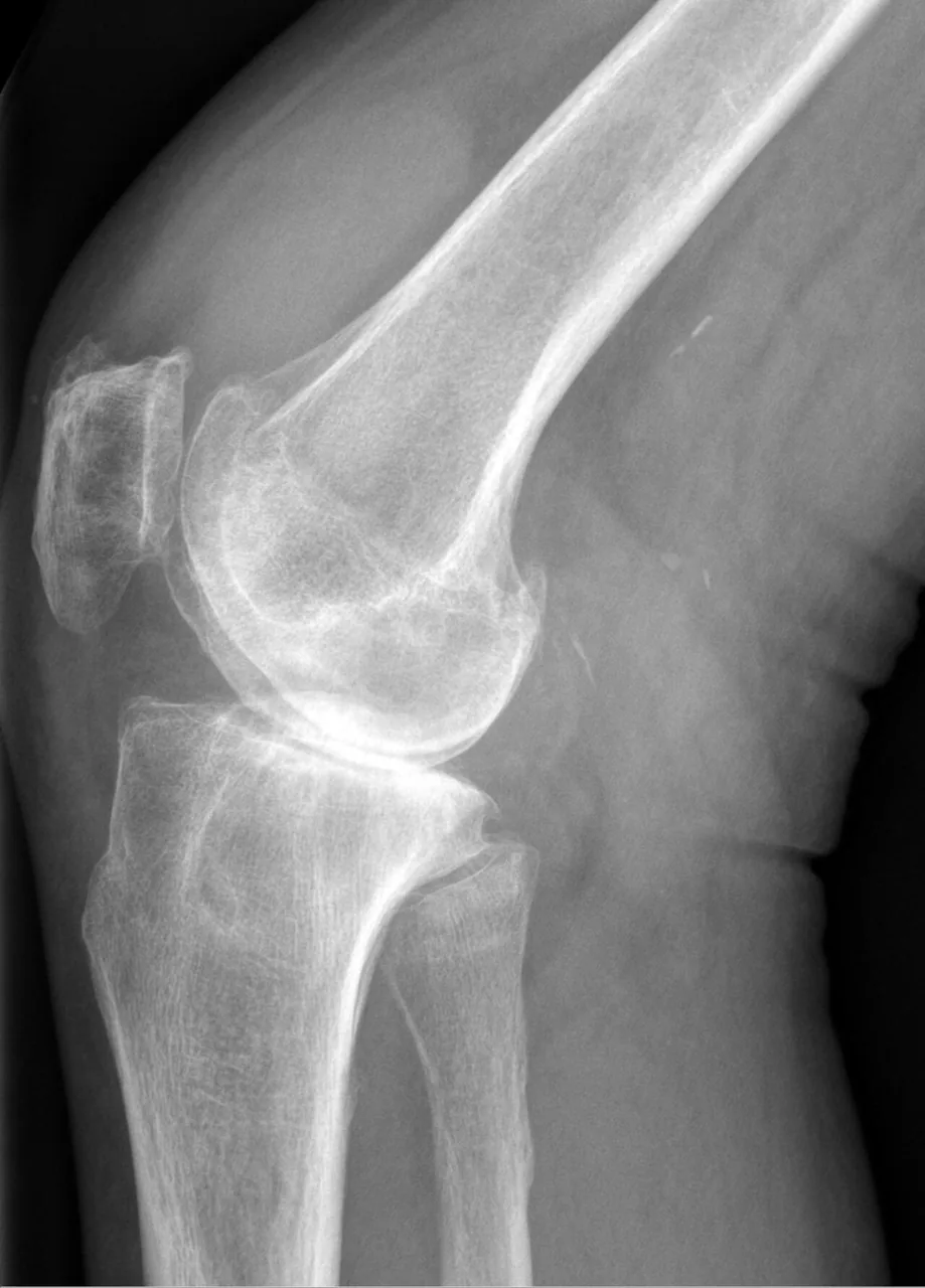 Lower limb radiograph for self-assessment