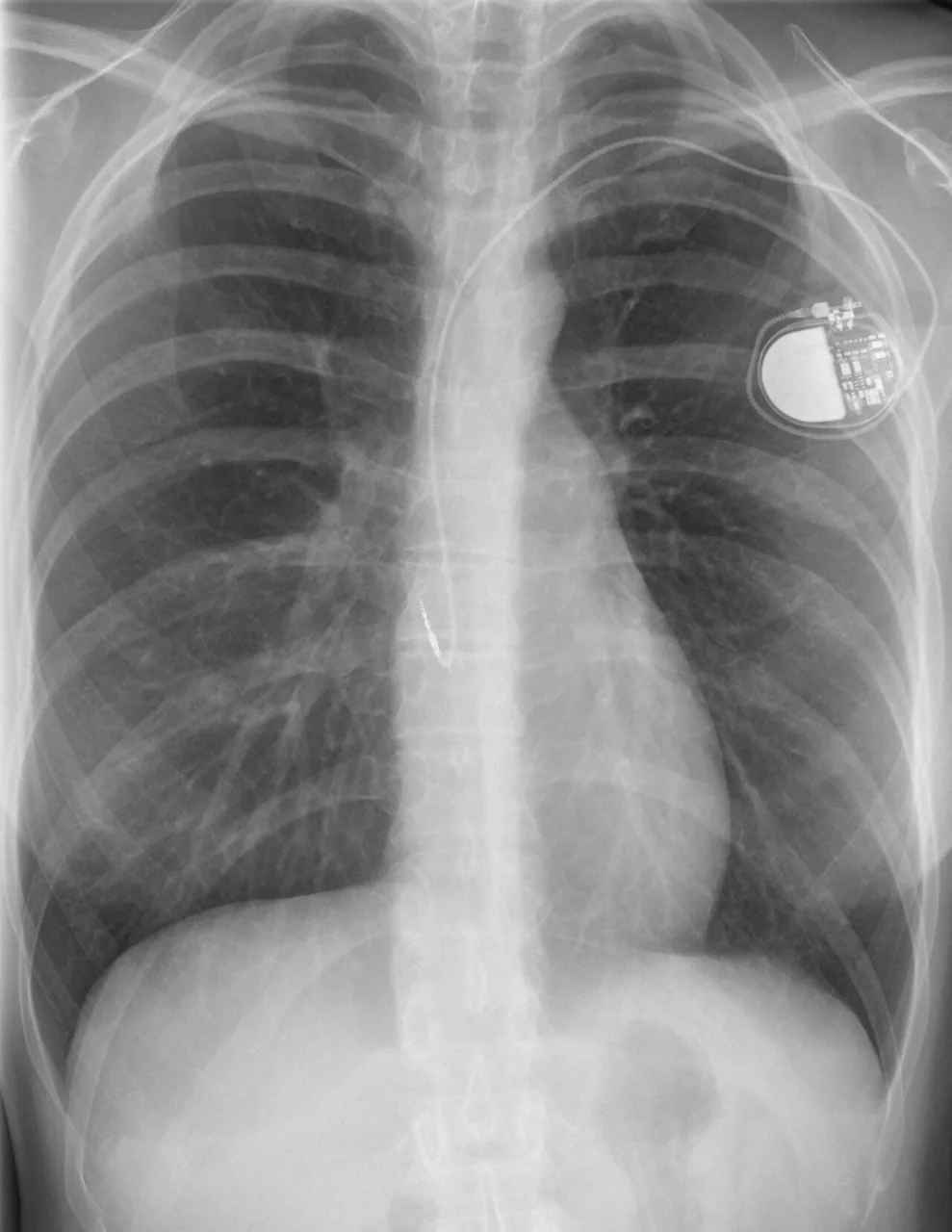Lines & tubes radiograph for self-assessment