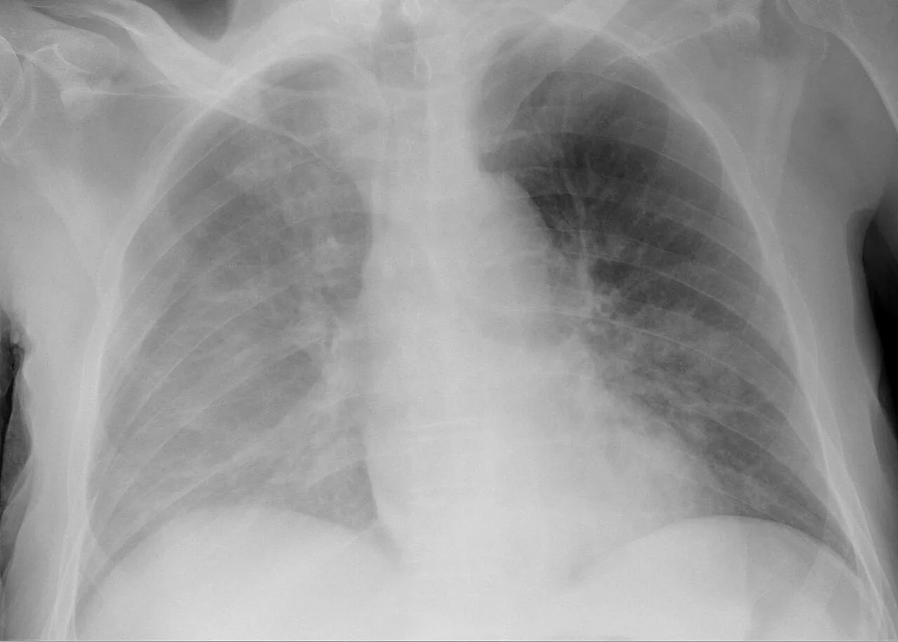 Chest radiograph for self-assessment