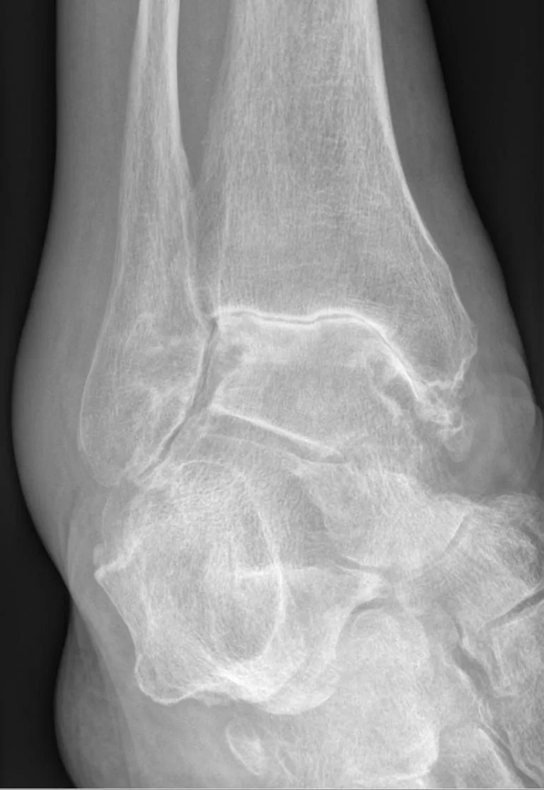 Bone & joint disease radiograph for self-assessment