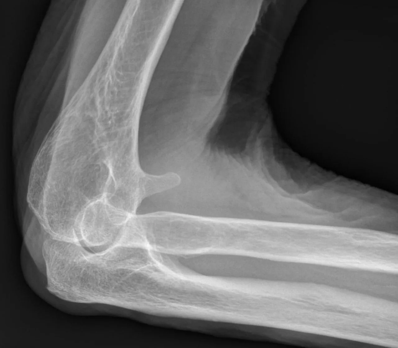 Bone & joint disease radiograph for self-assessment