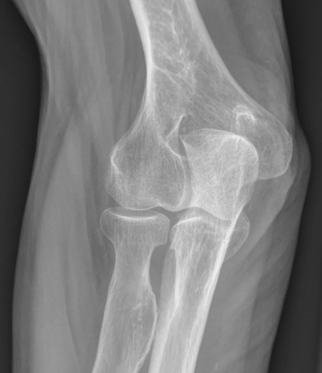 Bone & joint disease radiograph for self-assessment