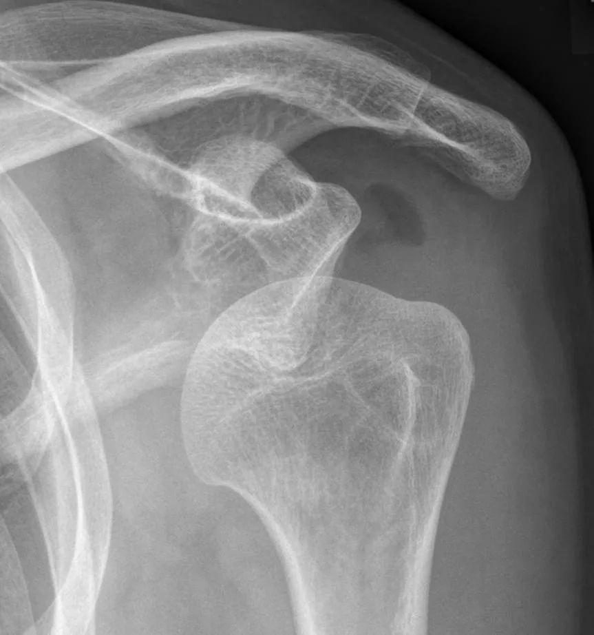 Upper limb radiograph for self-assessment