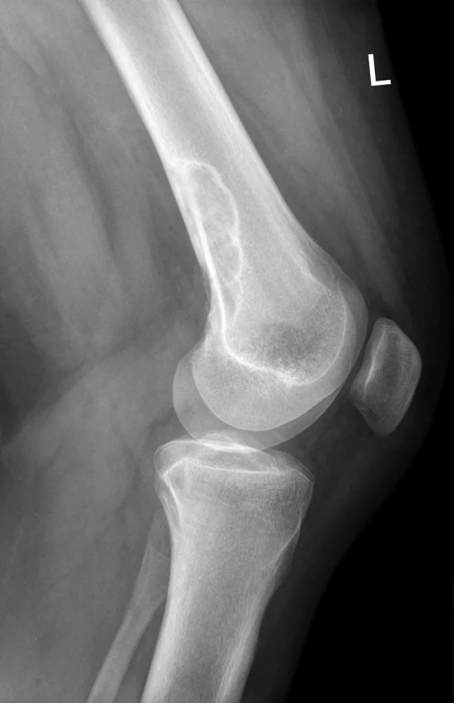 Bone & joint disease radiograph for self-assessment
