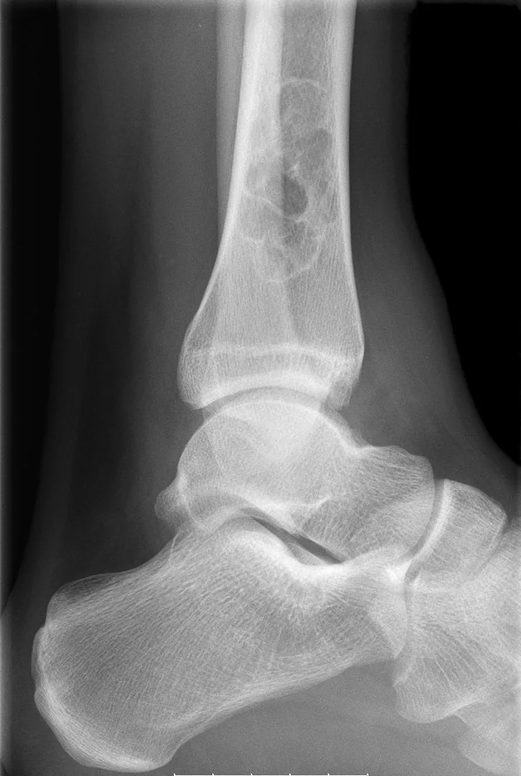 Bone & joint disease radiograph for self-assessment