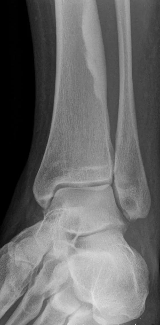 Bone & joint disease radiograph for self-assessment