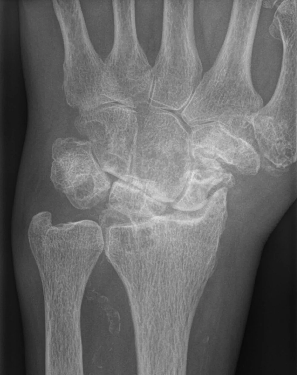 Bone & joint disease radiograph for self-assessment