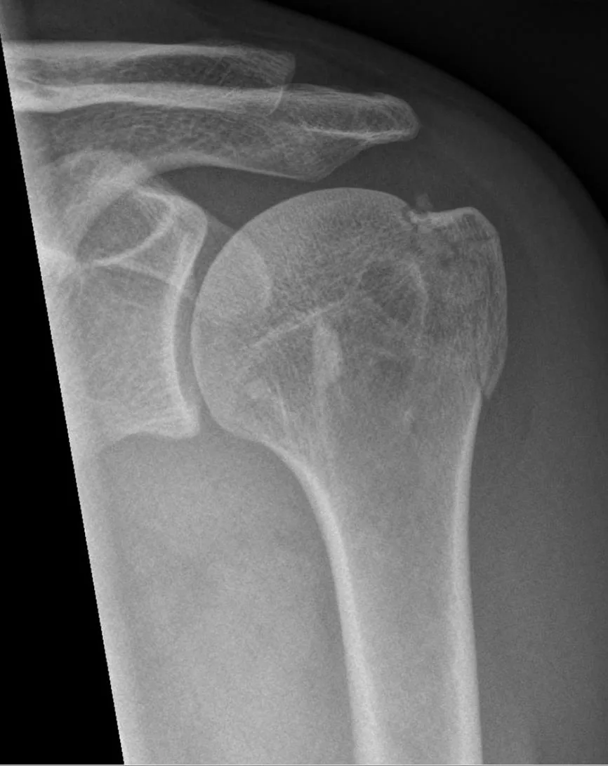 Upper limb radiograph for self-assessment