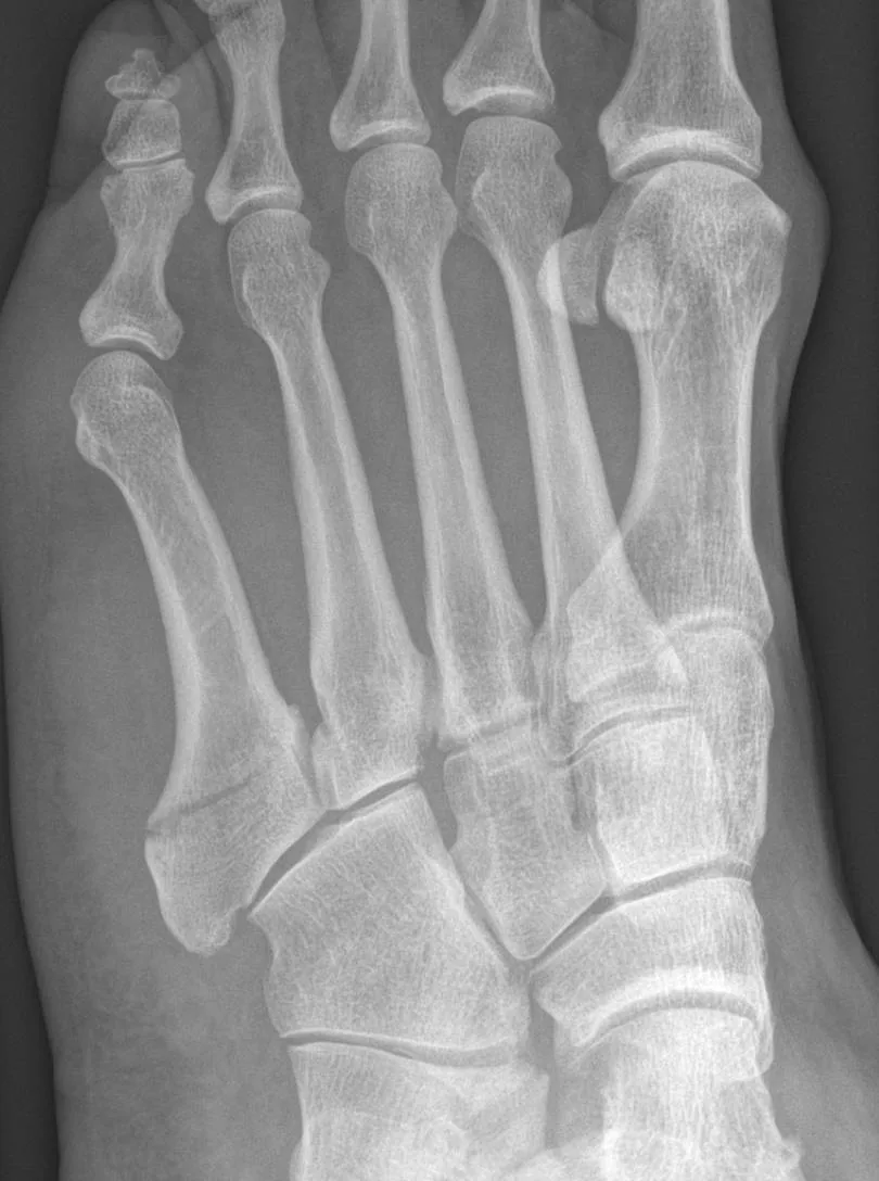 Lower limb radiograph for self-assessment