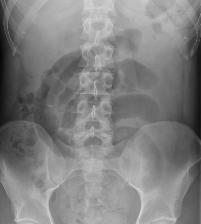 Abdomen radiograph for self-assessment