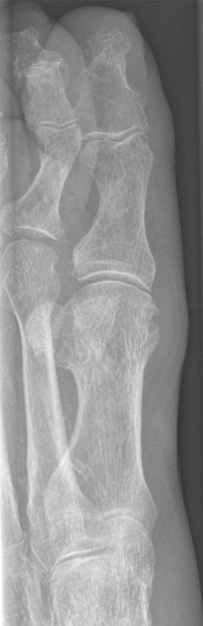 Bone & joint disease radiograph for self-assessment