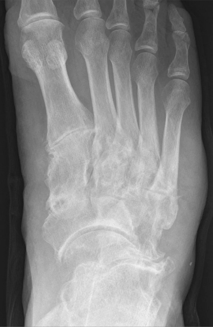 Bone & joint disease radiograph for self-assessment