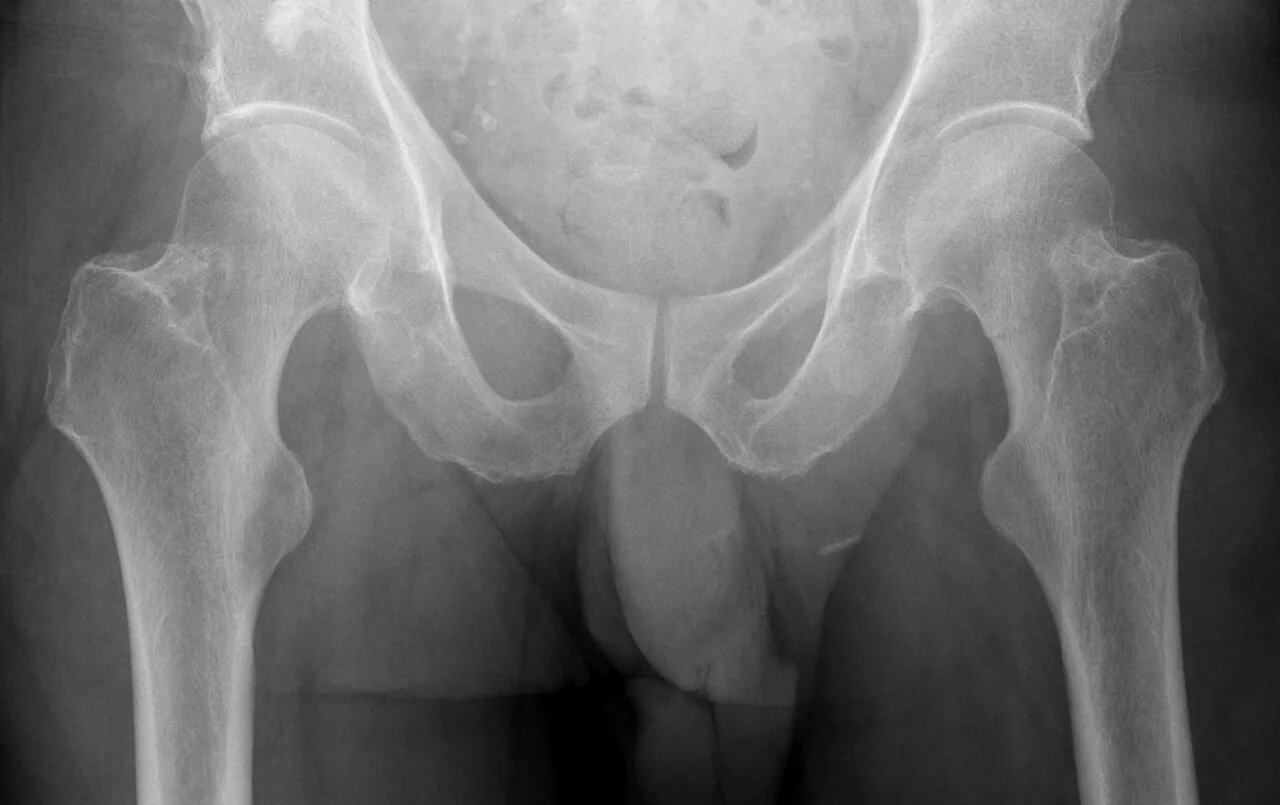 Lower limb radiograph for self-assessment