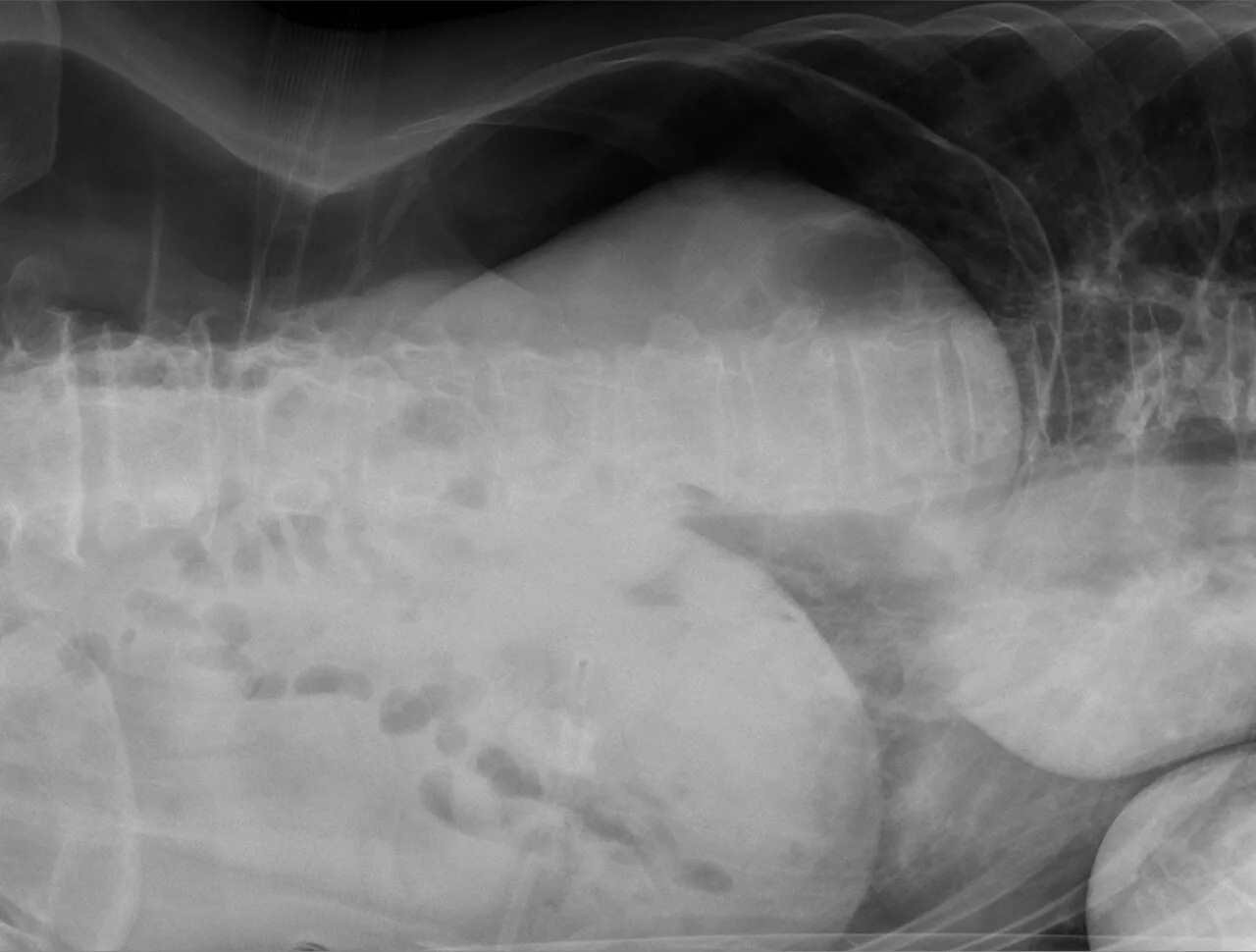 Abdomen radiograph for self-assessment