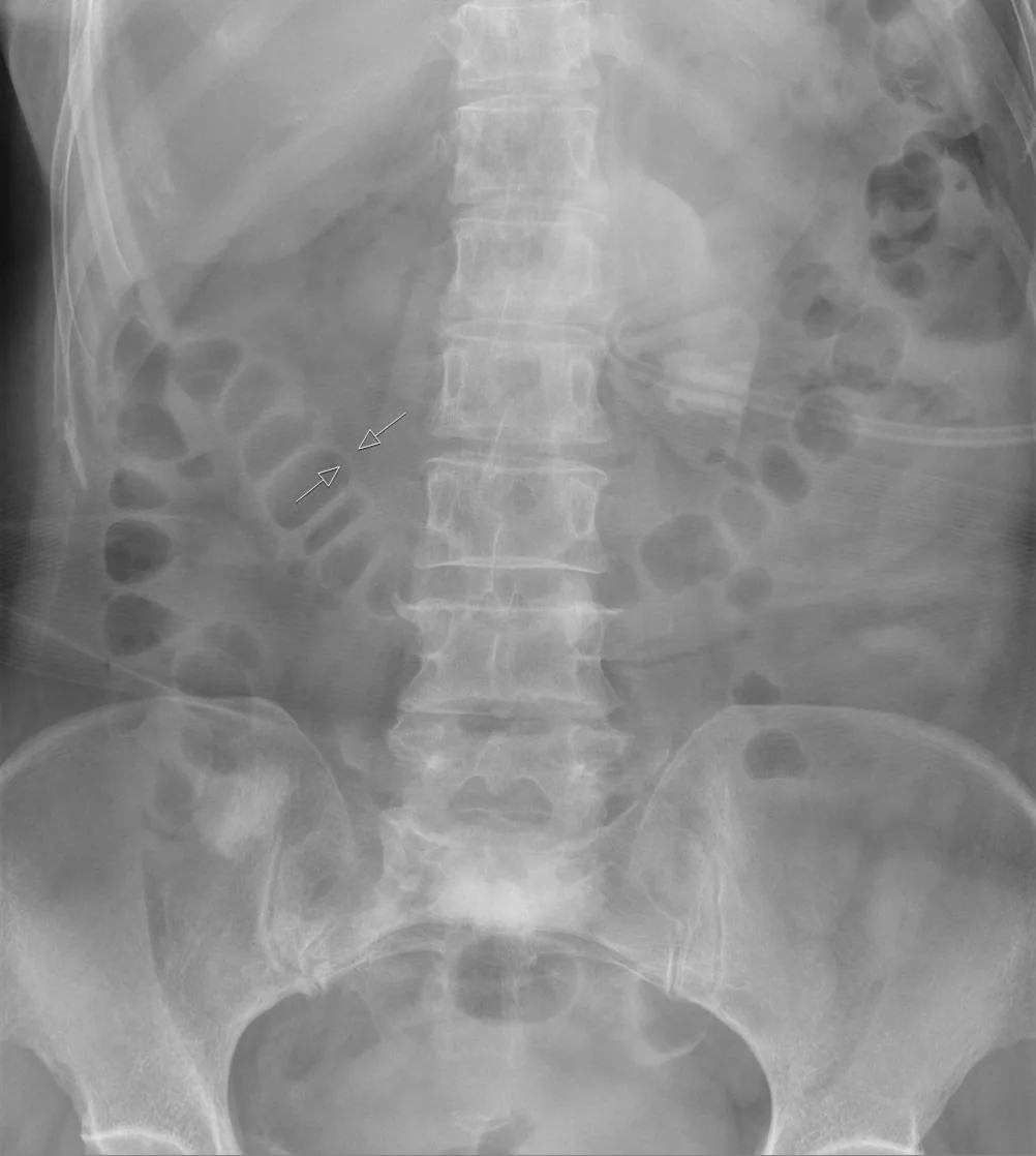 Abdomen radiograph for self-assessment