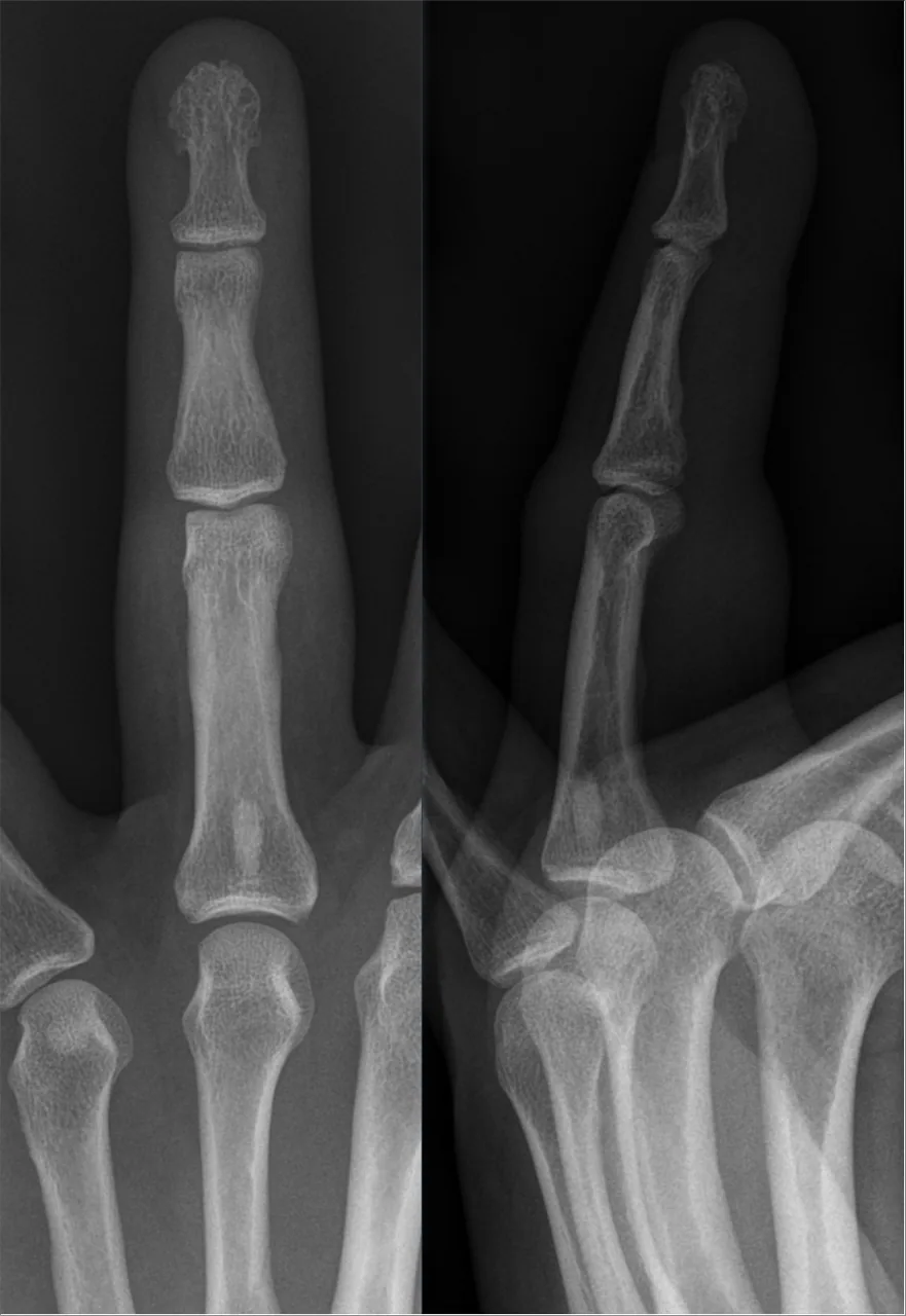 Bone & joint disease radiograph for self-assessment